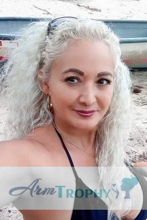 212553 - Ana Belly Age: 50 - Costa Rica